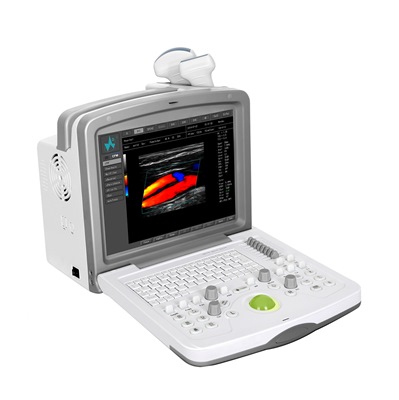 FDC6000 Full-Color Doppler Ultrasound System