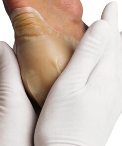 Alternative view of Hydrocoll (Similar to Granuflex) Hydrocolloid Dressing 15cm x 15cm (Singles)